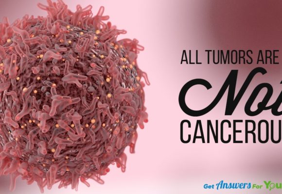 all-tumors-are-not-cancerous