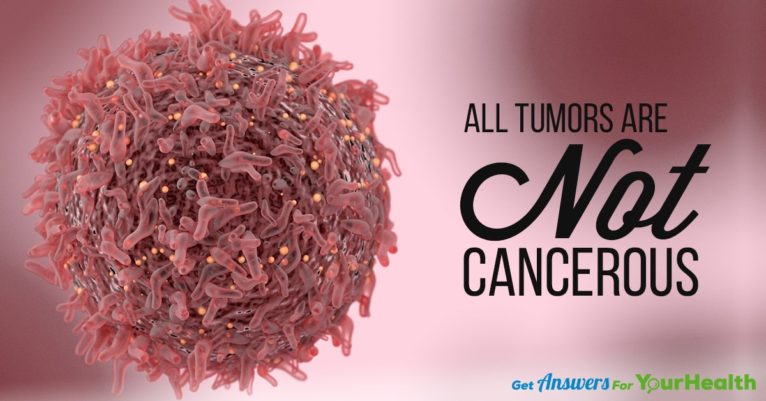 all-tumors-are-not-cancerous