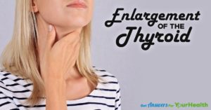 enlargement-of-thyroid