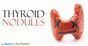 thyroid-nodules