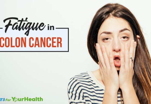 fatigue-in-colon-cancer